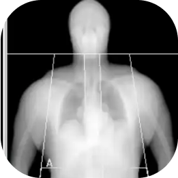 DEXA