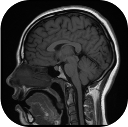 fMRI