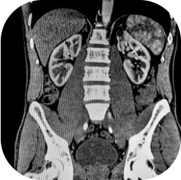 MRI