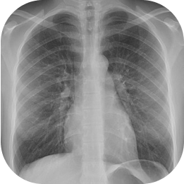 X-Ray